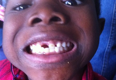 zion first lost tooth